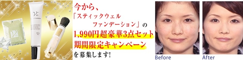 ���B�[�̃X�e�B�b�N�E�G���t�@���f�[�V�����R�_�Z�b�g���T�C�g